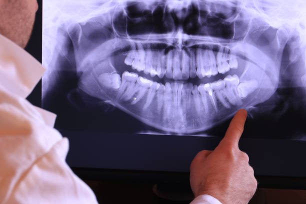 Best Emergency Dental Care for Broken or Chipped Teeth in Wheeler Af, HI
