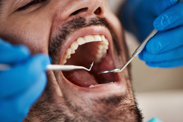 Best Emergency Tooth Extraction in Wheeler Af, HI