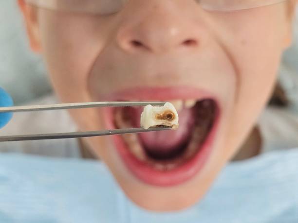 Best 24-Hour Emergency Dentist in Wheeler Af, HI