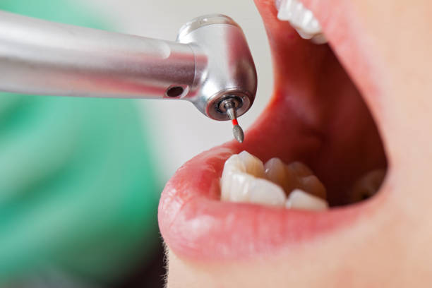Best Emergency Treatment for Dental Infections or Abscesses in Wheeler Af, HI